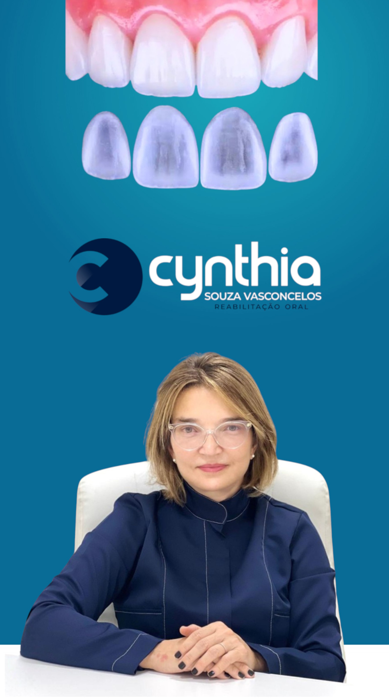 Dra. Cynthia Souza Vasconcelos - Reabilitação Oral